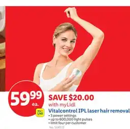 Lidl Vitalcontrol IPL laser hair removal offer