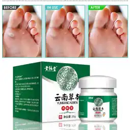 Walmart Openpig Clearance Corn Plaster Super Strong Made From Natural Plant Extracts For Foot And Body 20g offer