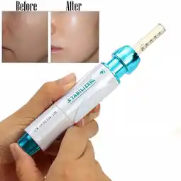 Walmart 0.5ML Skin Facial Beauty Machine Kit, Face Body Therapy Wrinkle Remove Device Home Spa offer