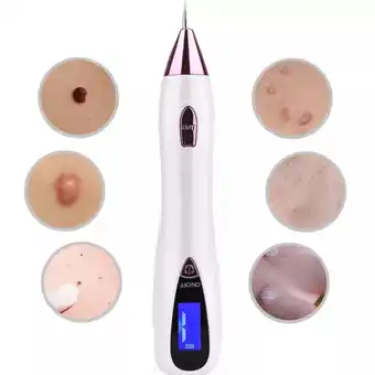 Walmart Dr.LPCGF Electric Wart Remover Pen for Common and Plantar Warts - White&Pink offer