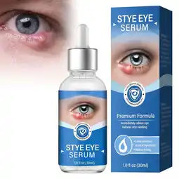 Walmart Stye Eye Treatment, Eye Serum Eye Cream for Chalazion and Blepharitis offer