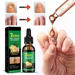 Walmart Skin Maximum For Nail Toenail 30ml Nail Nail And Intensity Care Nail Care Gingers Nail Solution offer