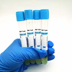 Walmart Newest 10ML Silver/Red/Clear PRP TUBES Anticoagulant (ACD-A) and BIOTIN Gel PRF TUBES (10 TUBES) offer
