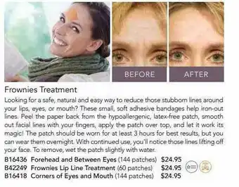 Frownies Treatment